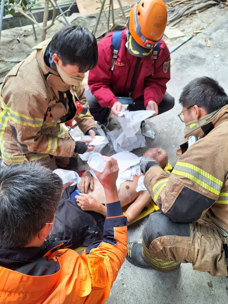 台籍男子全身多處傷燙傷。讀者提供