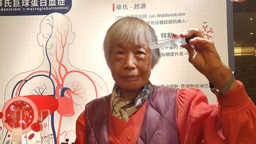 比閃電擊中機率低!她眼睛、牙齦、子宮狂出血 少見癌症上身