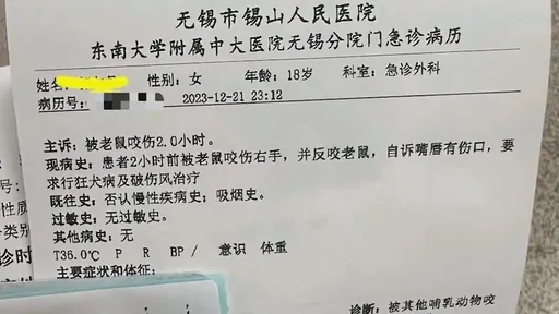 抓米奇被咬右手　18歲女大生「反咬老鼠天靈蓋」留下兩齒痕