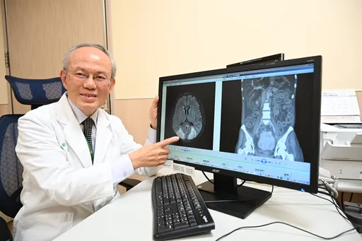 熟女腹痛、呕吐查无病因 血管炎再并发脑炎!红斑性狼疮惹祸