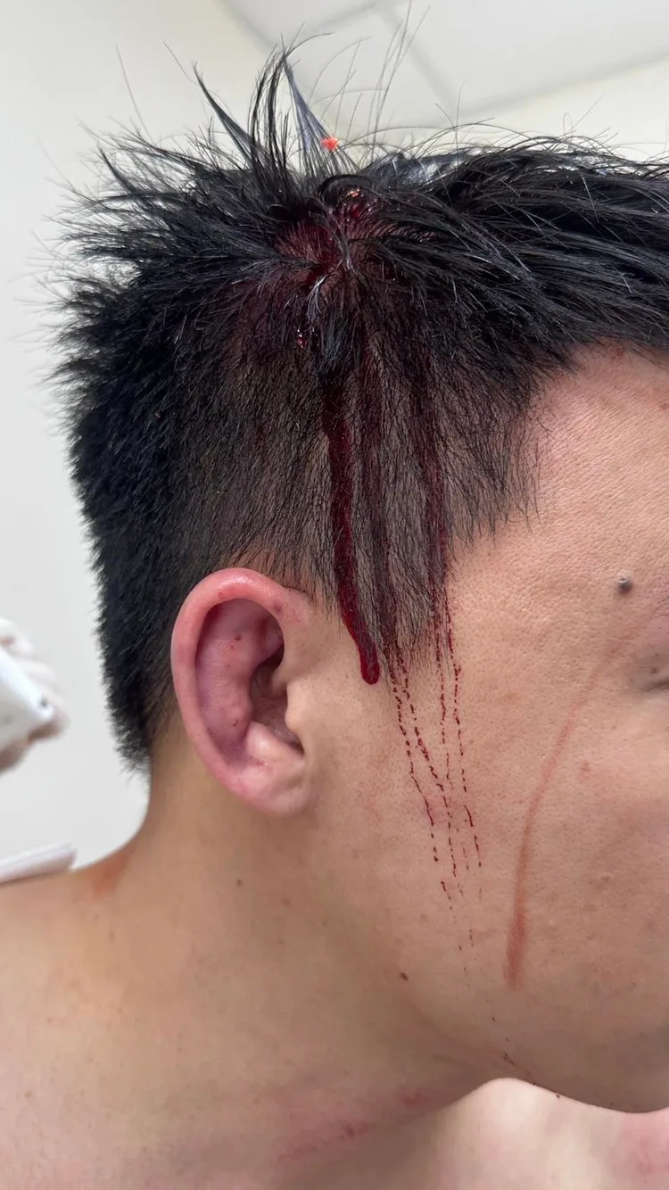 Toyz就醫治療畫面。翻攝自林男臉書