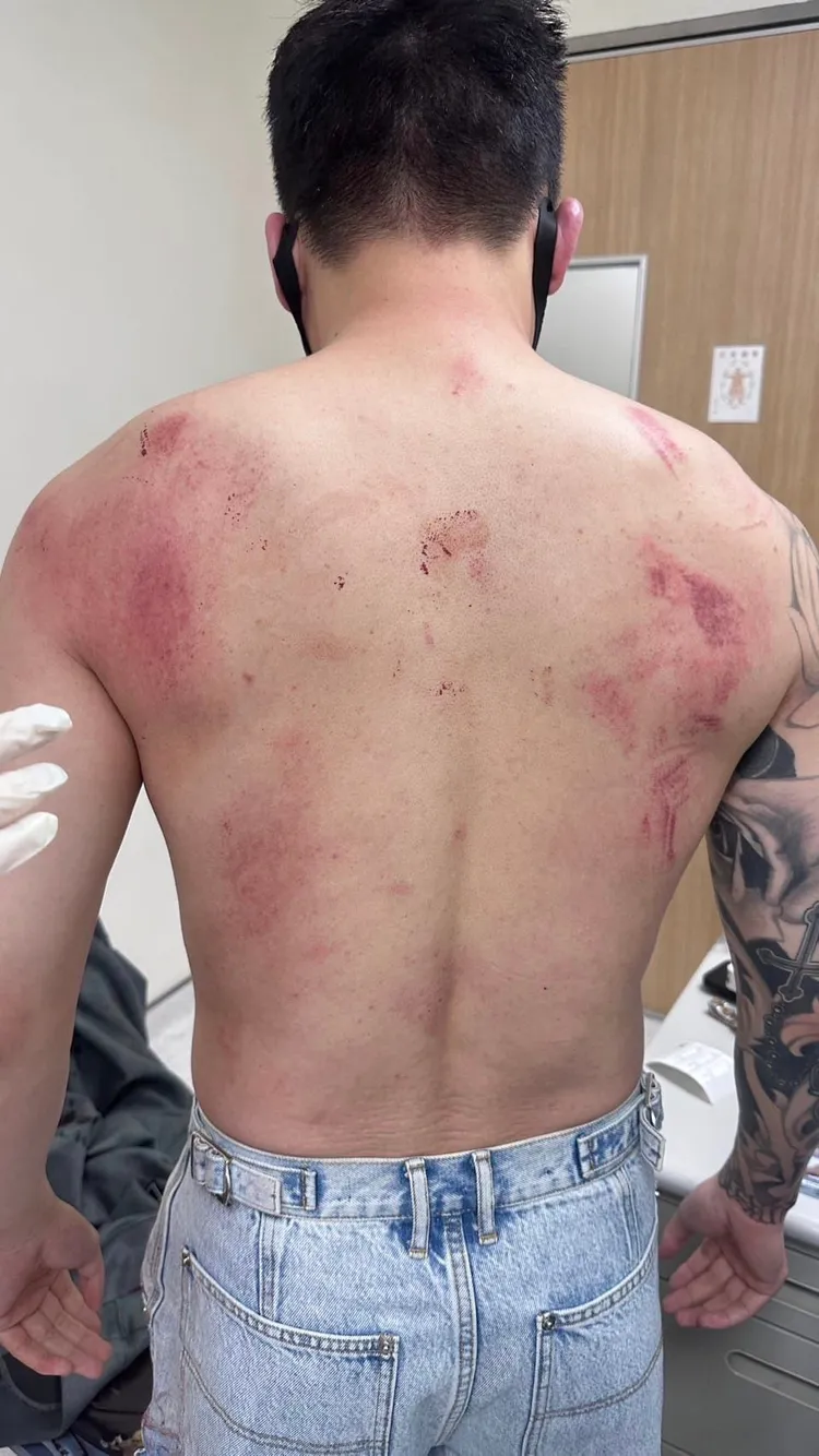 Toyz頭破血流，滿身是血。翻攝自林男臉書