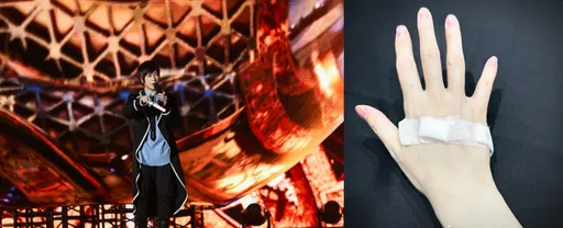 好心疼｜五月天阿信開唱前突曬緊急治療照　坦承有點沙啞真不好意思