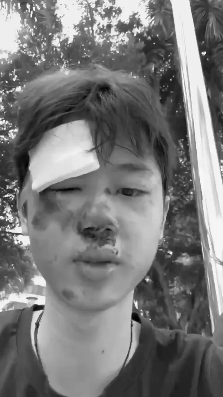 男騎士慘摔，臉腫得像豬頭。翻攝自記者爆料網