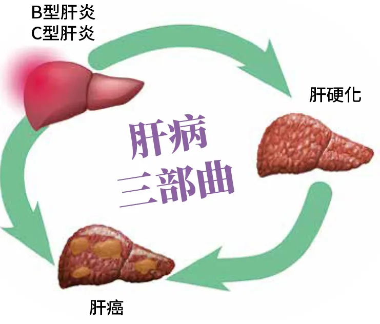 肝病防治學術基金會提醒，有B肝、C肝、肝硬化者務必定期抽血、接受腹部超音波檢查，才有機會早期發現癌細胞的蹤跡、有效治療；而曾罹患肝癌的病人更要密集追蹤。肝基會提供