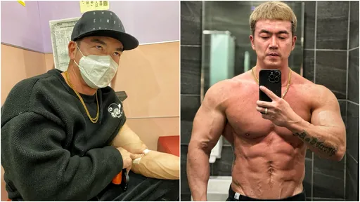 6年沒感冒!李沛旭曝病容照 大嘆:接種新冠疫苗後超慘