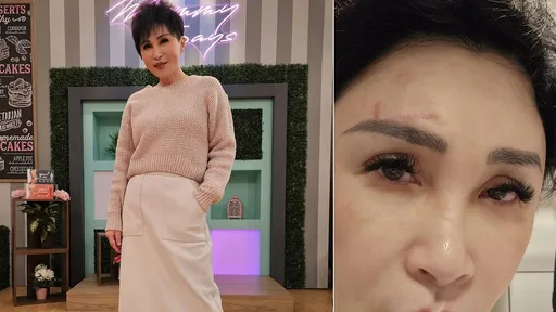 名嘴王瑞玲自家廁所昏倒慘撞洗手台 同住家人沒發現傷勢照曝光