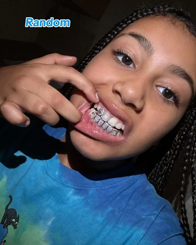 金卡達夏的女兒North West最近戴上了要價1萬4000美元（約43萬8000元）的鑽石牙套。翻攝northwest IG