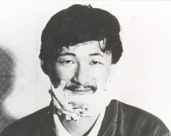 施明德因美麗島事件被捕時，下巴因易容手術貼著紗布。翻攝施明德臉書
