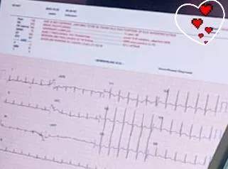 何淵智醫師呼籲，心律不整不可忽視或心存僥倖。阮綜合提供