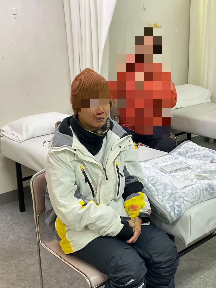 女子破相就醫。翻攝自記者爆料網