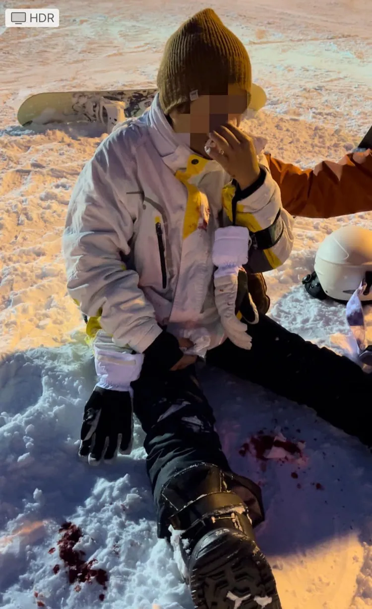 女子遭撞傷，濺血雪地。翻攝自記者爆料網