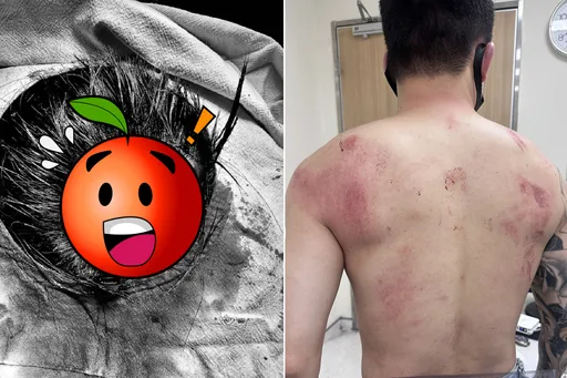 Toyz反擊了!曝驗傷單控超哥毆頭10分鐘 毒舌評醋飯「是我太笨」