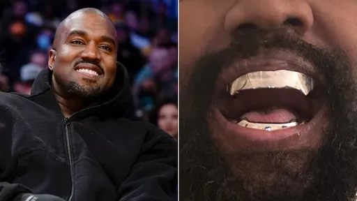 《007》大鋼牙真實版 肯爺滿口「鈦合金假牙」豪砸2700萬元