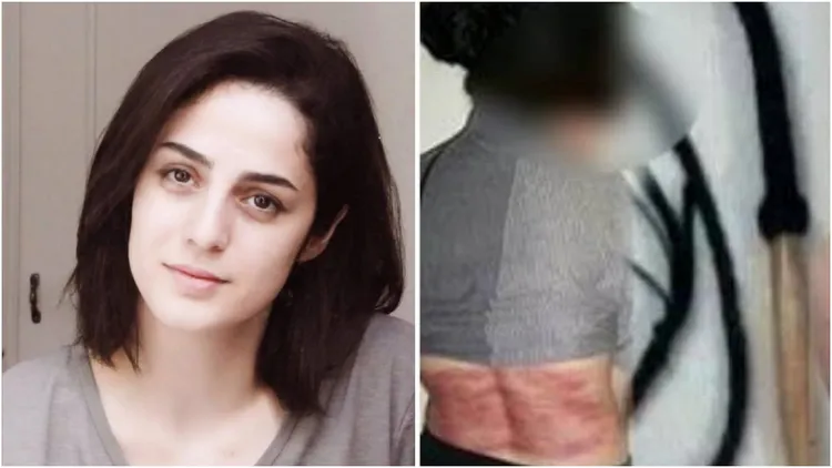 伊朗女子赫什馬蒂（Roya Heshmati）因未戴頭巾被鞭刑74下，推特網友相當同情她的遭遇。翻攝自社群X(推特)