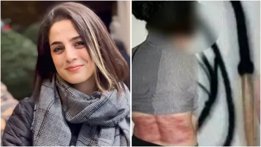 未戴頭巾!伊朗女子遭鞭刑74下 官方斥:可恥慫恿放縱行為