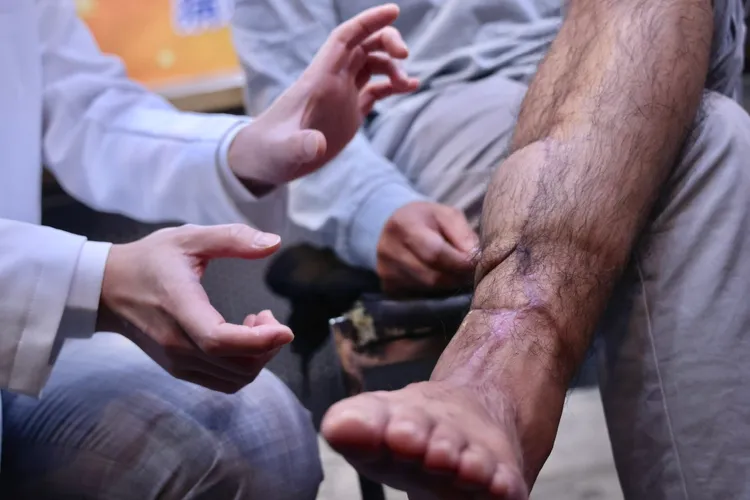 基隆長庚醫療團隊花費12小時成功替吳先生植回斷肢。林林攝