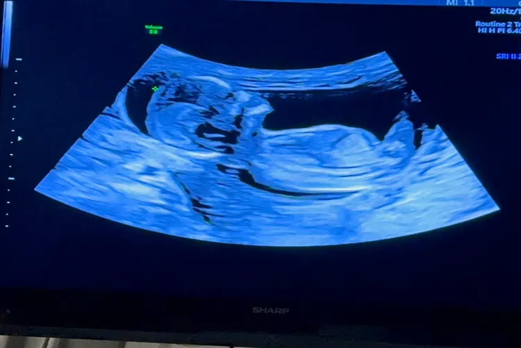 貝比的超音波照片十分清晰。劉香慈提供