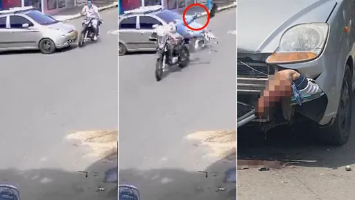 駭人片｜騎士飆速擦撞轎車　「右腿瞬間拔斷」卡進車頭狂冒血