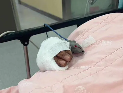 吃宵夜被砍！勇爸護女「腳趾掉腳筋斷」　她喊：砍錯人了