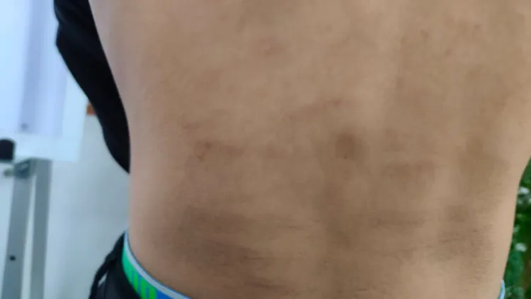 黃姓少年傷勢。詹江村提供