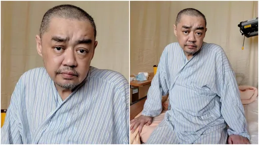 吾爾開希摔落樓梯「昏迷指數3」　親曝病榻照：恢復速度連醫生都驚訝