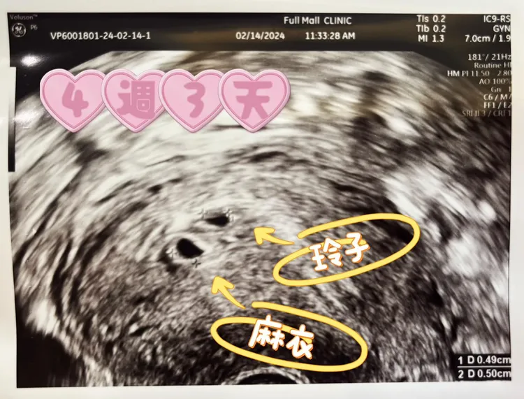 李宓曬出超音波照。翻攝李宓臉書