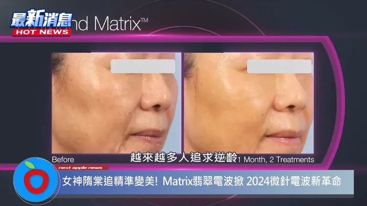 「Matrix翡翠電波」除了對抗老化效果明顯，針對各種問題肌膚也能有感改善。