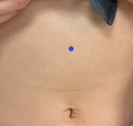 「中脘」位於肚臍正上方，吃太多導致腹脹、胃痛等可按摩此處。徐敬閔提供