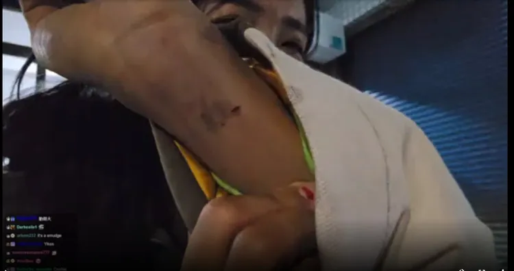 企鵝妹出示手臂遭蜂炮炸傷的傷勢，讓粉絲相當心疼。翻攝自論壇PTT