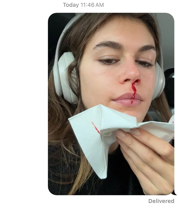 她在IG分享嗨玩到流鼻血的畫面。翻攝kaiagerber IG