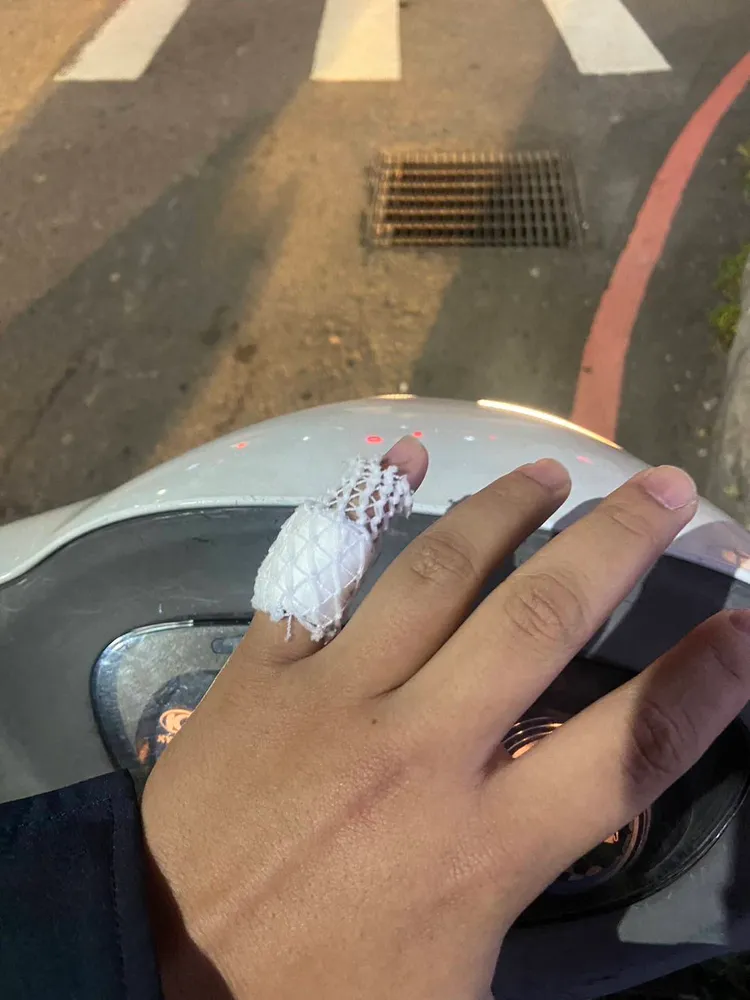 林姓男警小拇指受傷。翻攝畫面