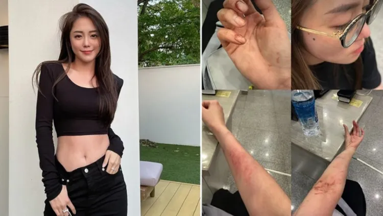 林千又po出被打得滿身傷照片。翻攝林千又IG