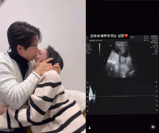 李志勳公開胎兒超音波影片，開心狂吻aya。翻攝aya IG