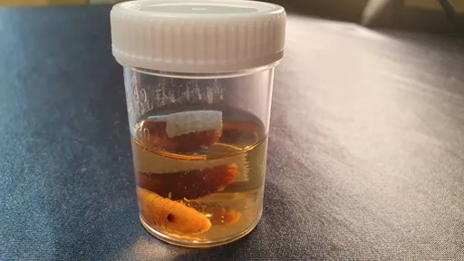 马蝇靠这招爬上身!常寄生头皮和脸 中南美旅游4方式自保
