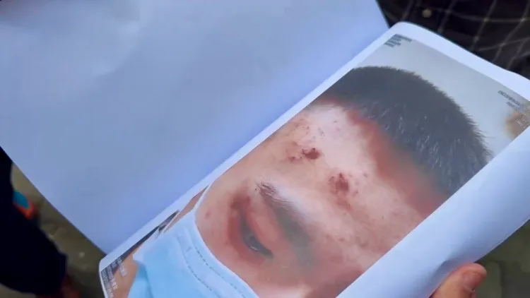 律師出示少年遭員警刑求成傷的照片。讀者提供