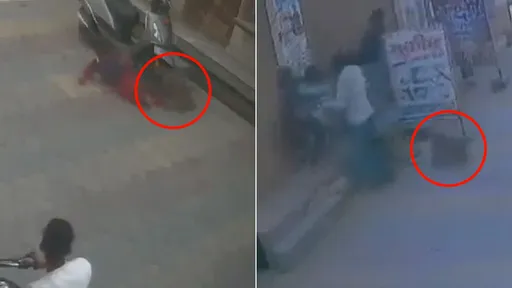 影片｜男童當街遭猴子攻擊負傷　眾人目擊卻無人伸援