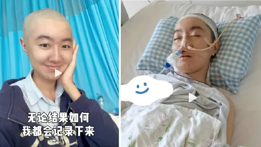 超紅童星患罕見腦瘤開刀掙扎生死關頭賺同情！網友揪出3疑點媽媽道歉了
