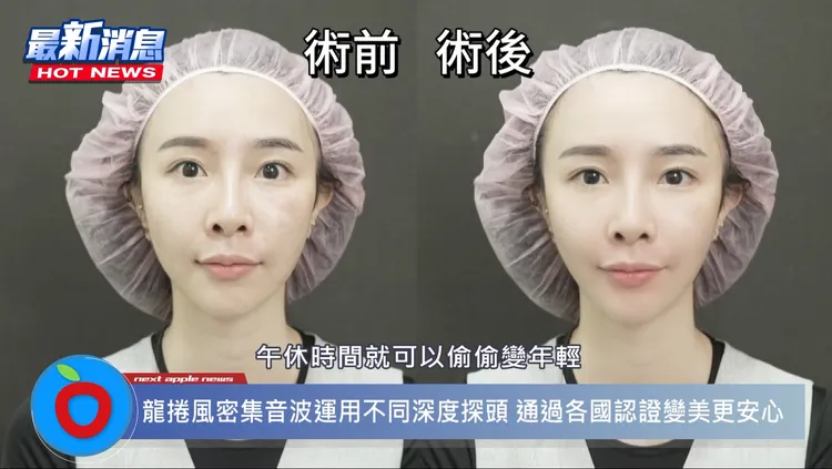 「龍捲風密集音波」，利用午休時間就能悄悄變美，也帶動一股愛美風潮席捲台灣。