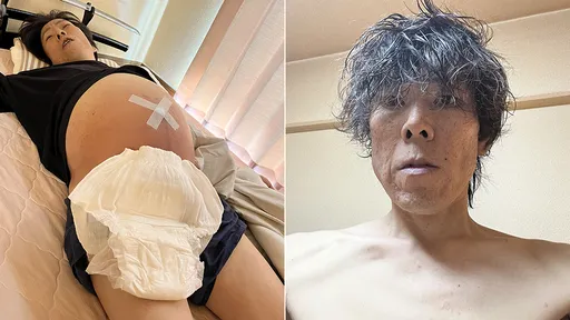 酗酒網紅1張照片超警世　47歲「已經做好死亡的準備」