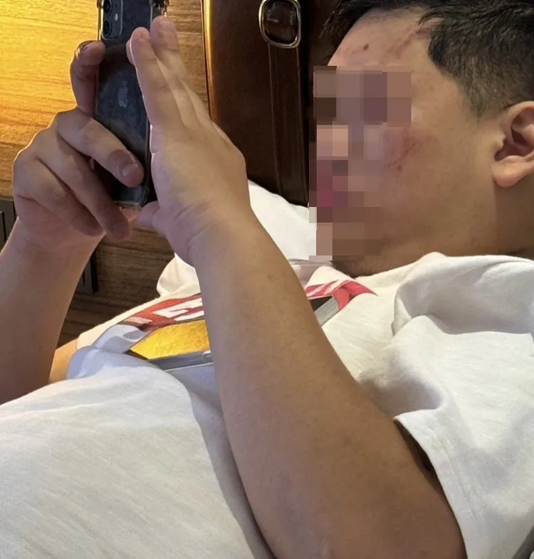 柚柚被警方拘留一晚，隔天帶著傷口返回飯店。柚柚提供