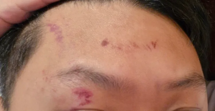 柚柚遭警制壓在地，頭部受傷。柚柚提供