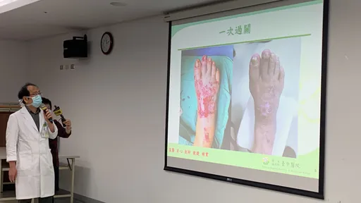 92歲嬤右腳遭車輾過!腳皮整片掀起 高壓氧治療奇蹟復原