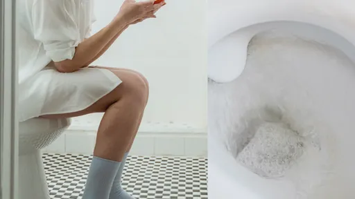 為何想大便卻先尿尿? 竟是跟「肌肌」有關