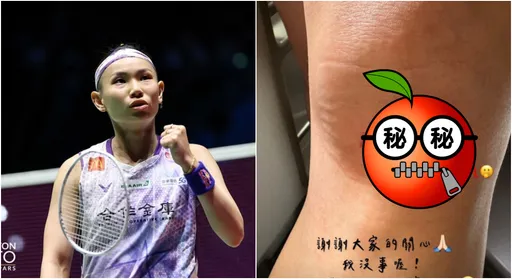 戴資穎受傷!傷勢照曝光 直奔醫院「把打開的皮蓋回去」