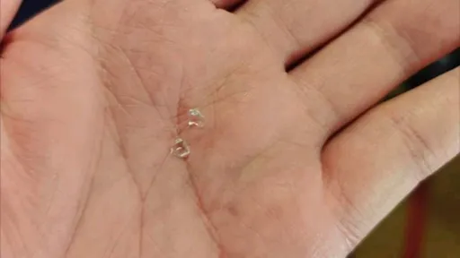 家長控客房「碎玻璃」害幼兒滿嘴血 義大天悅:家長未注意導致