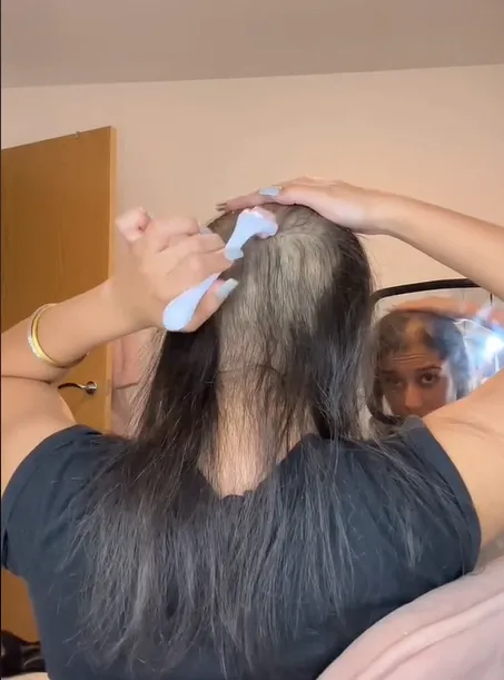 大眼正妹使用「微針滾輪」按摩頭皮。TikTok@parvsahota5