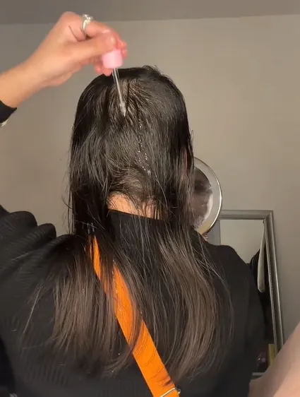 在頭髮開始再生後，大眼正妹使用天然髮油護髮。TikTok@parvsahota5