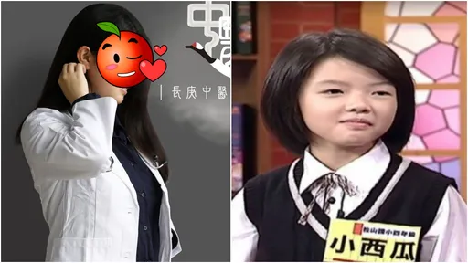 「小西瓜」女大18變!網驚呼太漂亮 醫學系才女首曝綽號誰取的