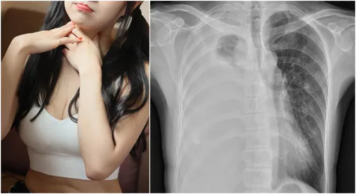 她咳1個月驗出肺癌末 醫師曝關鍵時間點!必做這動作